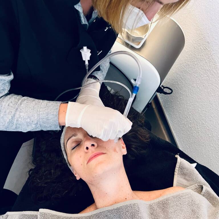 Soin Jet Peel au Centre CMB à Clermont-Ferrand