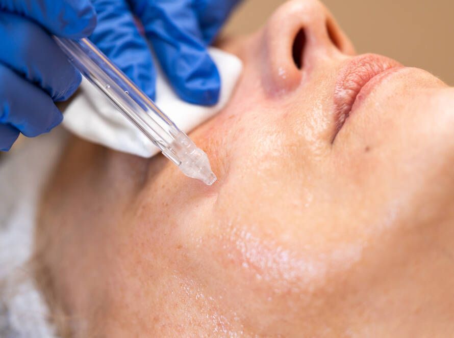 Soins anti-âge à Clermont-Ferrand