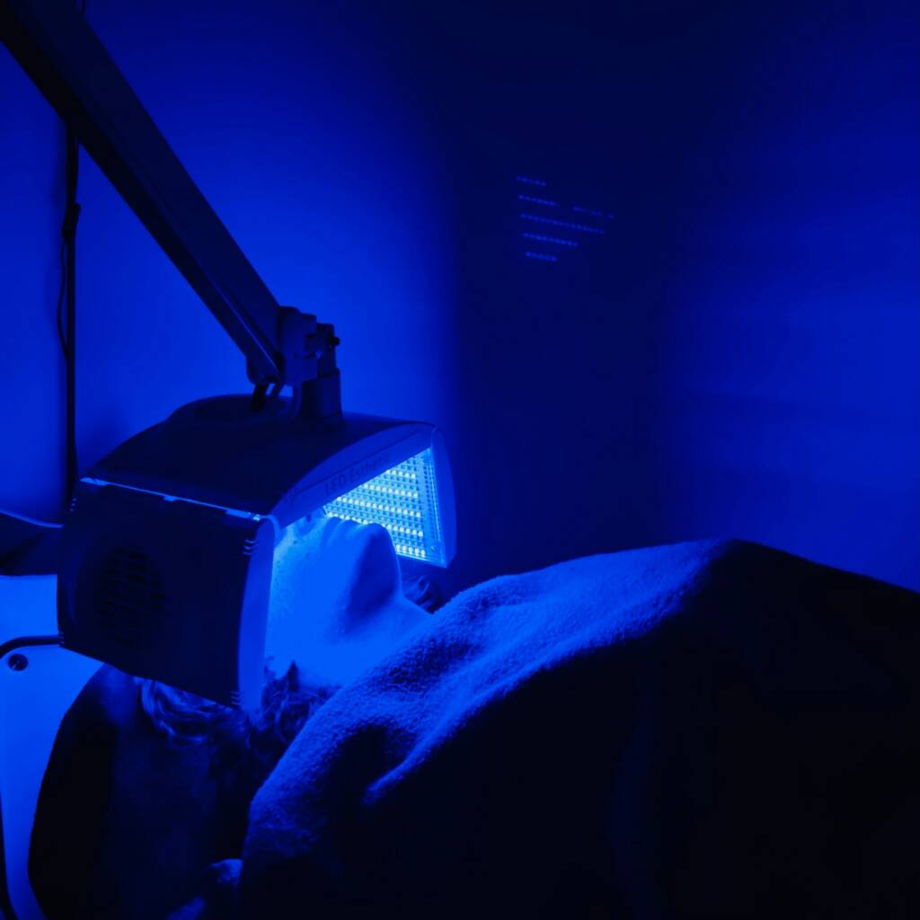 Soin peau acnéique et séquelle acné par LED au Centre CMB