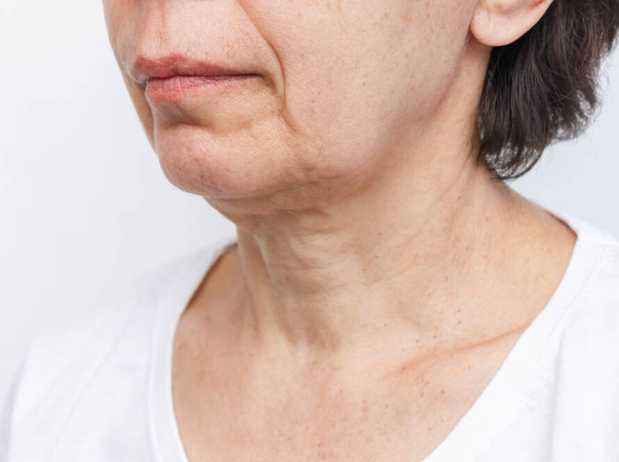 Rajeunissement cou décolleté Clermont-Ferrand